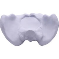 Customized Hip Bone Stress Relievers